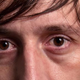 Illustration for article titled What Causes Dark Circles Under Your Eyes?